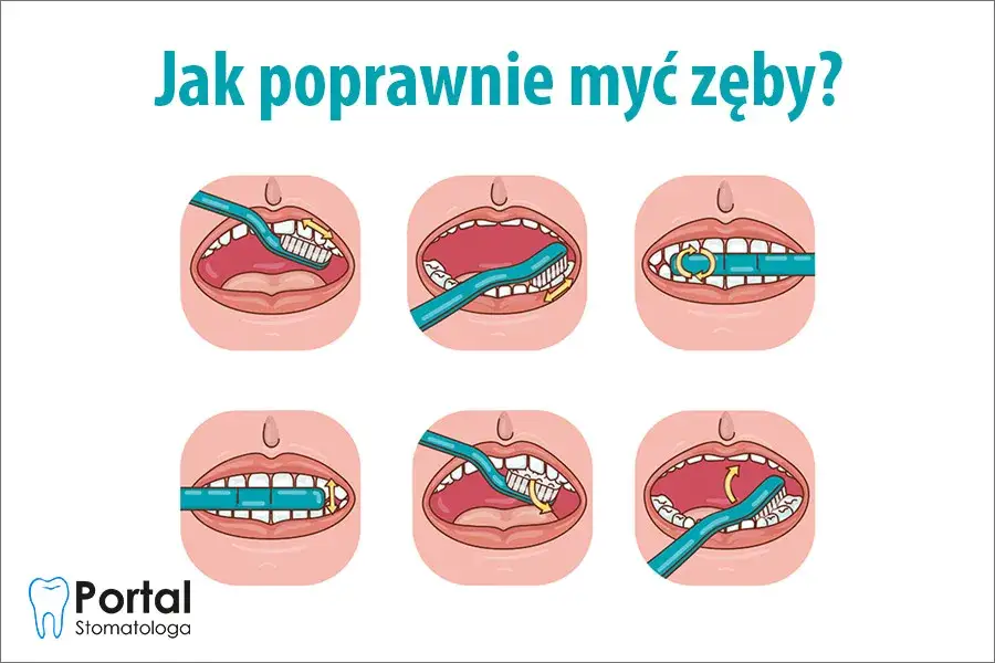 Jak myć zęby szczoteczką soniczną? Pełny przewodnik krok po kroku
