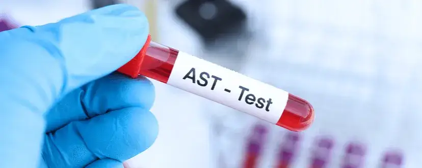 AST (Aminotransferaza): Rozszyfruj wyniki, normy i przygotowanie