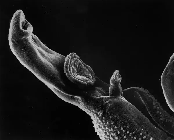 Pasożyty a objawy psychiczne: Jak infekcje wpływają na zdrowie emocjonalne