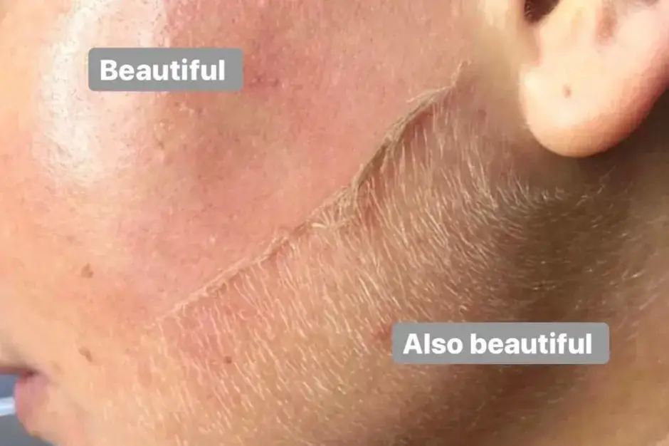 Czy golenie twarzy jest dobre? Odkryj korzyści i ryzyka tej metody