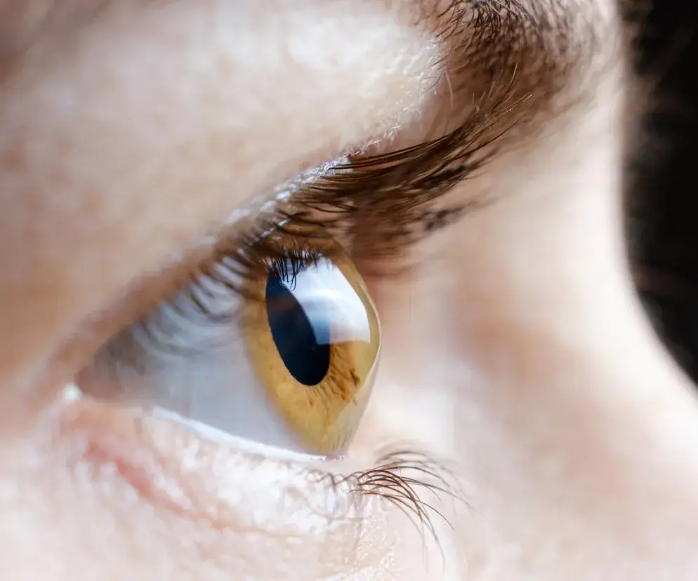 Oczy jak szpilki: co oznaczają rozszerzone źrenice i ich przyczyny