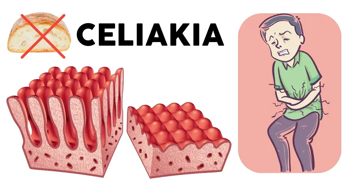 Celiakia, alergia, NCNG: co gluten robi w organizmie? Ekspert wyjaśnia