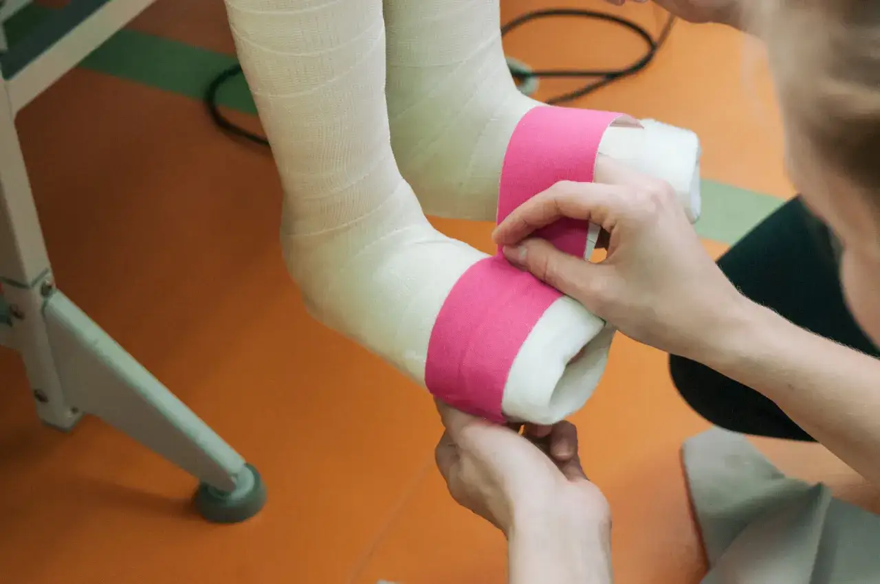 Pieczenie pod gipsem jest normalne? Sprawdź, co to oznacza dla Ciebie