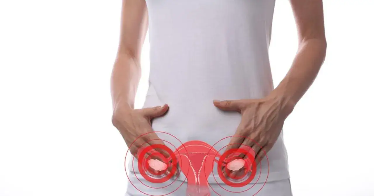 Pęknięcie torbieli jajnika: objawy, co robić i kiedy wezwać pomoc