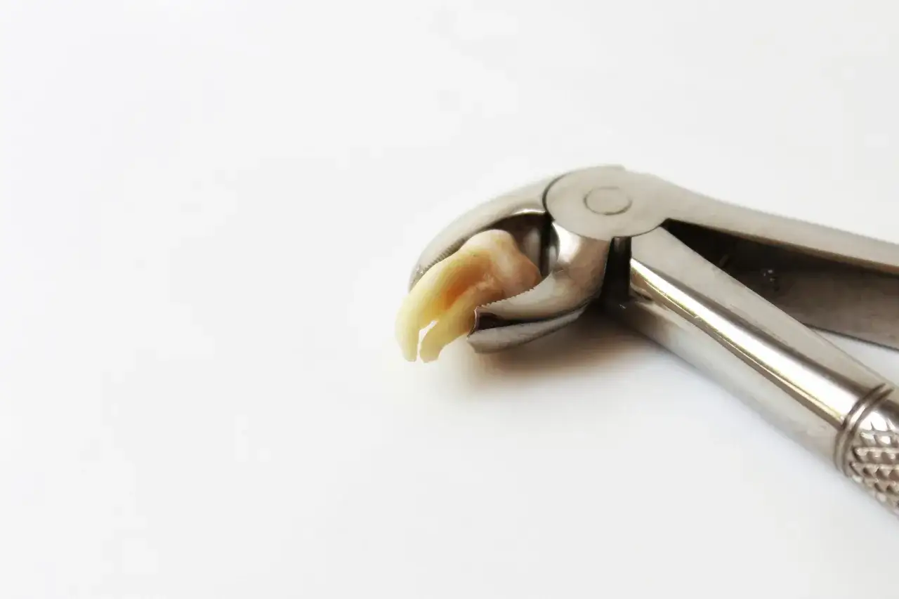 Alkohol po wyrwaniu ósemki? Kiedy bezpiecznie się napić?