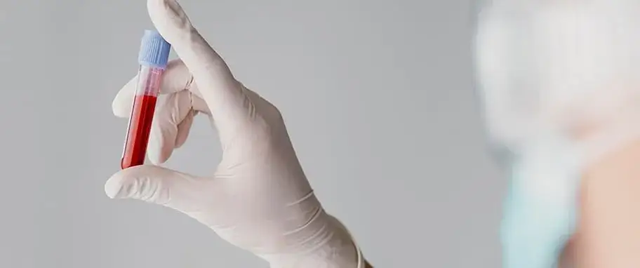 OB (Odczyn Biernackiego): Co oznacza Twój wynik? Pełny przewodnik