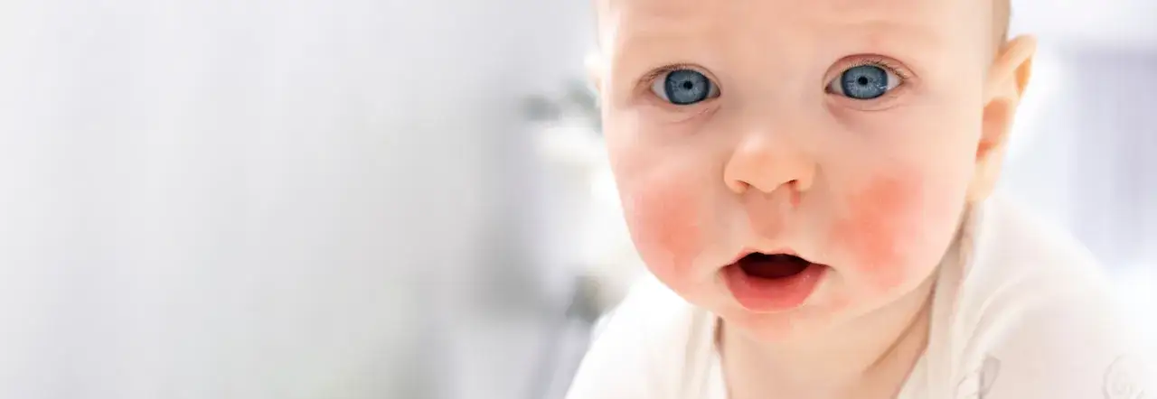 Czy burak uczula? Objawy alergii i co warto wiedzieć o ryzyku