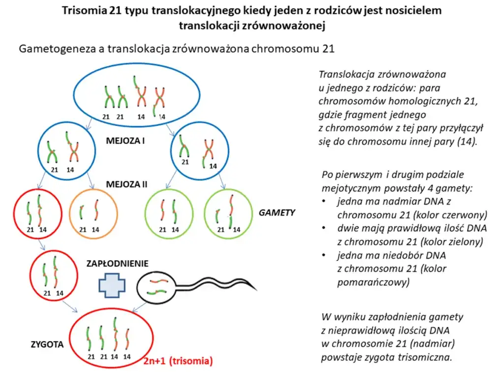Zespół Downa: objawy, diagnoza i życie z trisomią 21