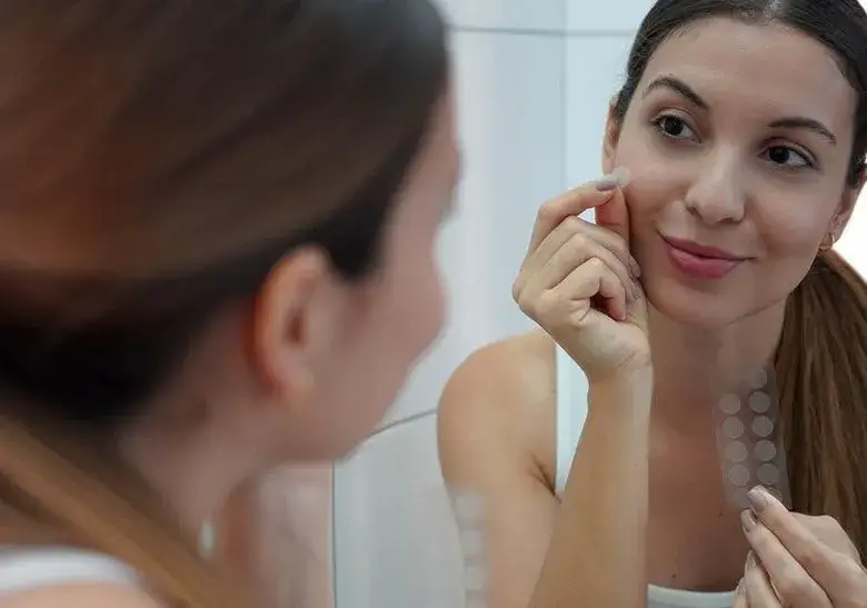 Wyciśnięty pryszcz: natychmiastowa pomoc i pielęgnacja bez blizn