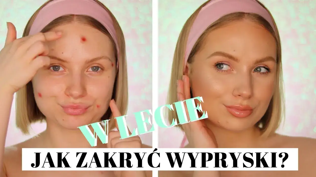 Szybkie sposoby na zaczerwienienie pryszcza: Dom, apteka, makijaż