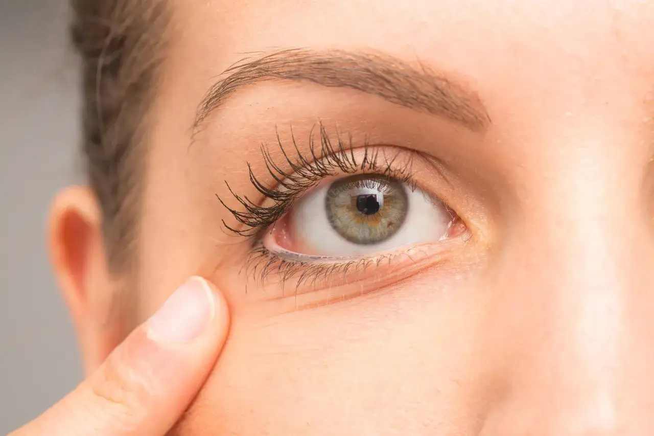 Uczulenie na tusz do rzęs objawy – jak je rozpoznać i co robić