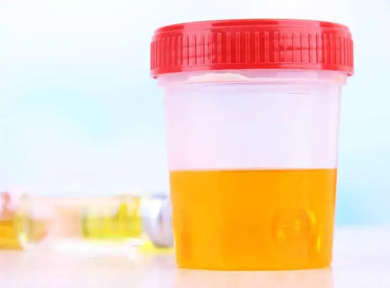 Czy przed badaniem moczu można współżyć? Sprawdź, co musisz wiedzieć