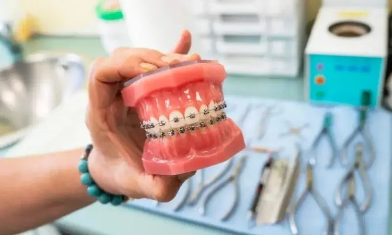 Ile kosztuje aparat? Ceny, modele i ukryte koszty [2024]