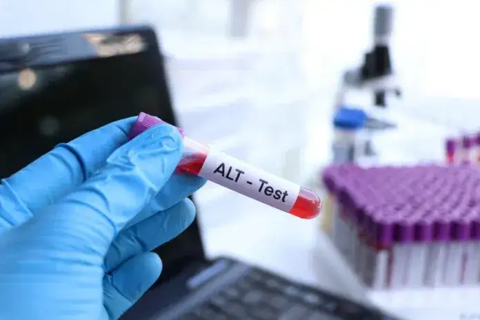 ALT co to za badanie? Rozszyfruj wyniki i zadbaj o wątrobę!