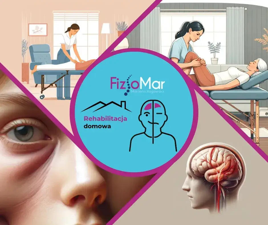 Rehabilitacja po udarze mózgu: Odzyskaj sprawność. Pełny poradnik
