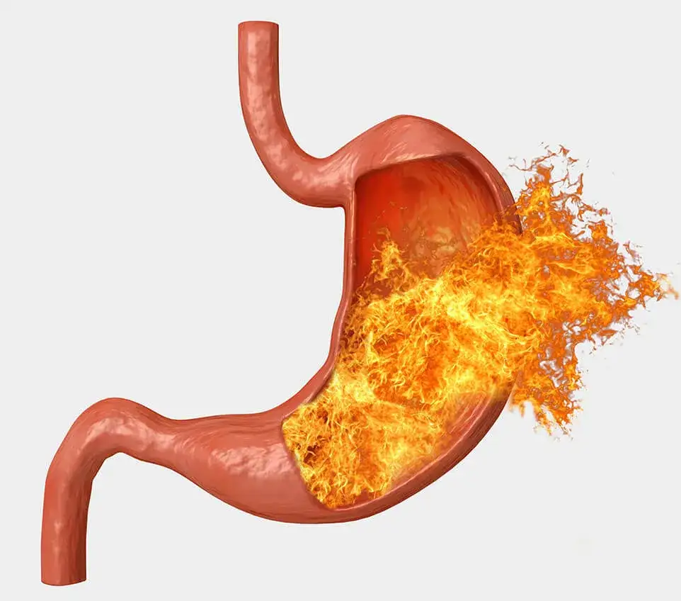 Do jakiego lekarza z refluksem? Kto pomoże i jak leczyć tę dolegliwość?