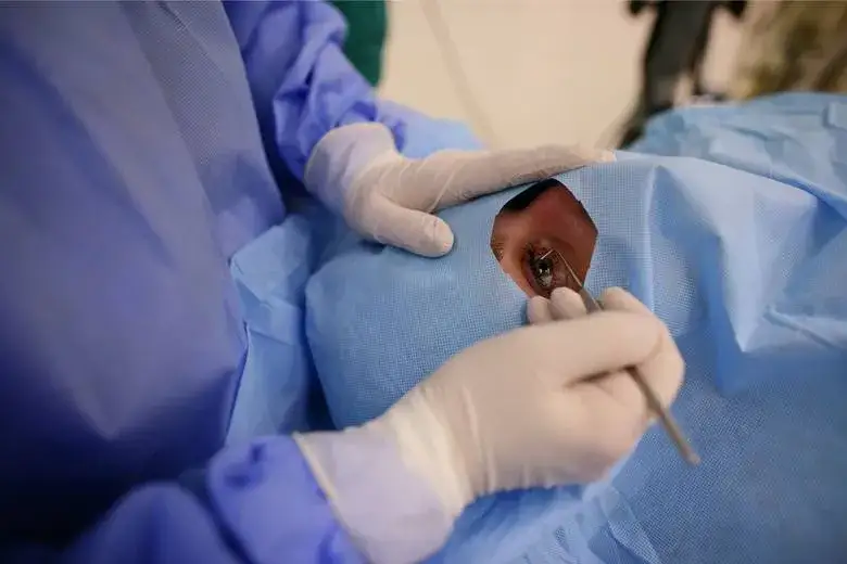 Jak okulista wyciąga coś z oka i co musisz o tym wiedzieć