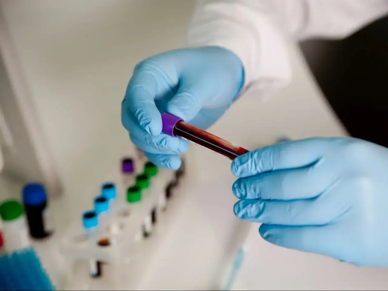 Badanie krwi: jak się przygotować? Uniknij błędów, zyskaj pewne wyniki!