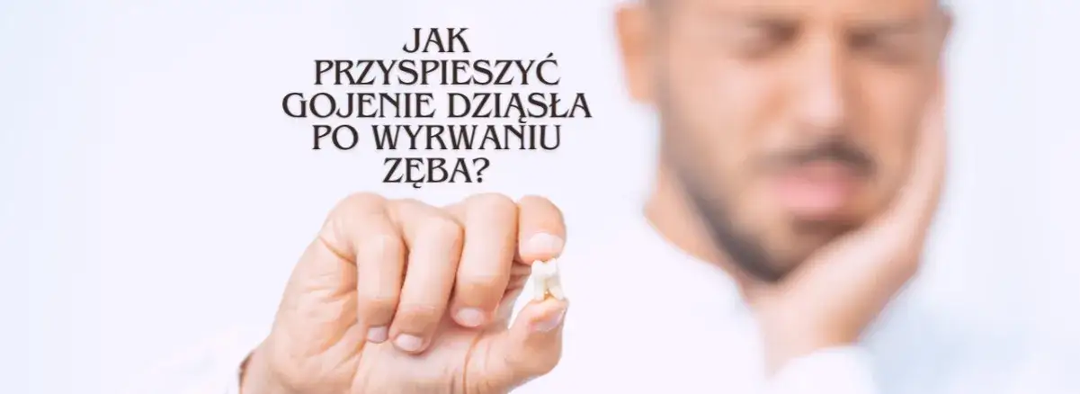 Gojenie dziąsła po wyrwaniu zęba: przewodnik i objawy alarmowe