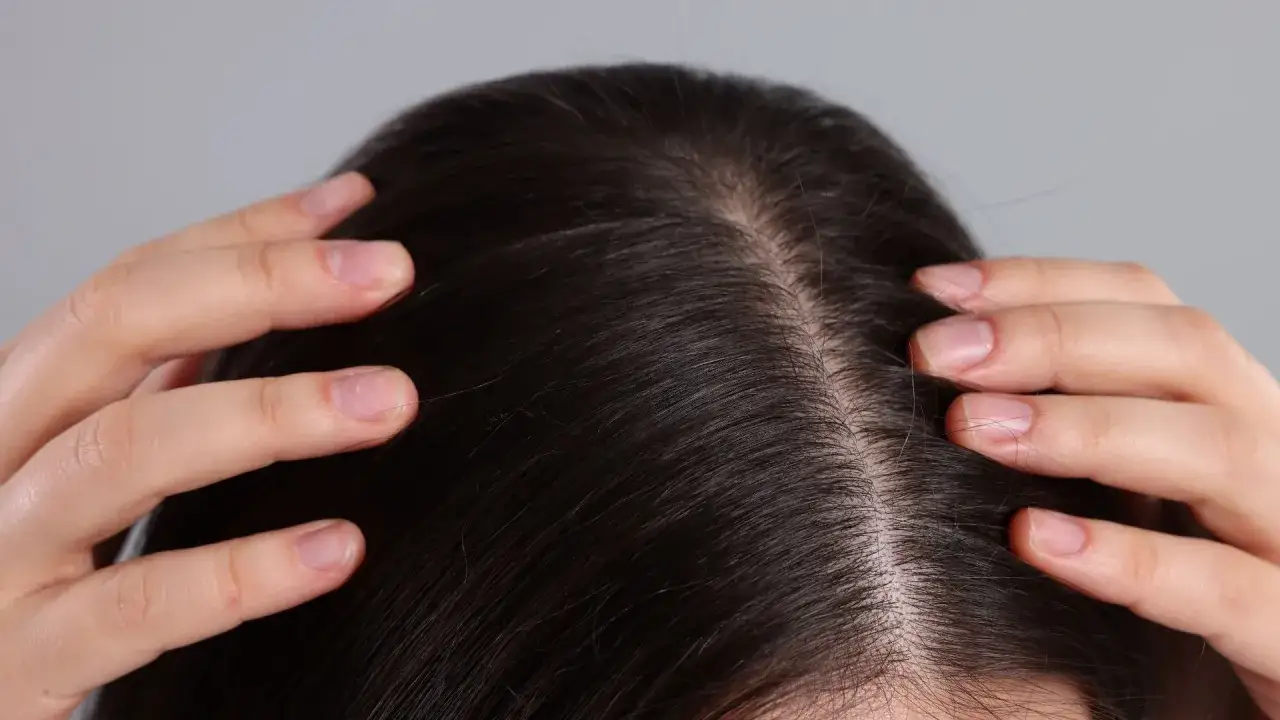 Peeling skóry głowy: Jak dobrać idealny i pozbyć się problemów?