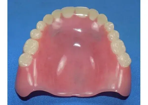 Pęknięta proteza? Jak naprawić tymczasowo i kiedy iść do protetyka