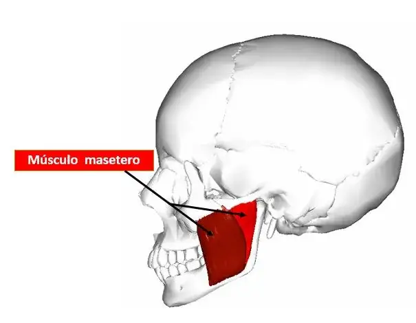 Dolor de masetero: Alivia la tensión mandibular y el bruxismo