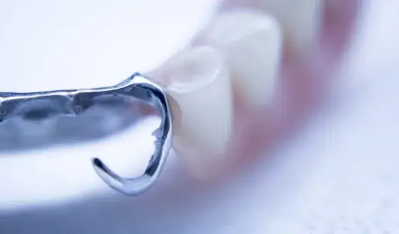 Jak usunąć klej do protez z dziąseł? Skuteczne metody bez bólu