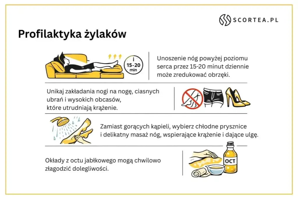 Jak zapobiec żylakom? Pełny przewodnik do zdrowych nóg!