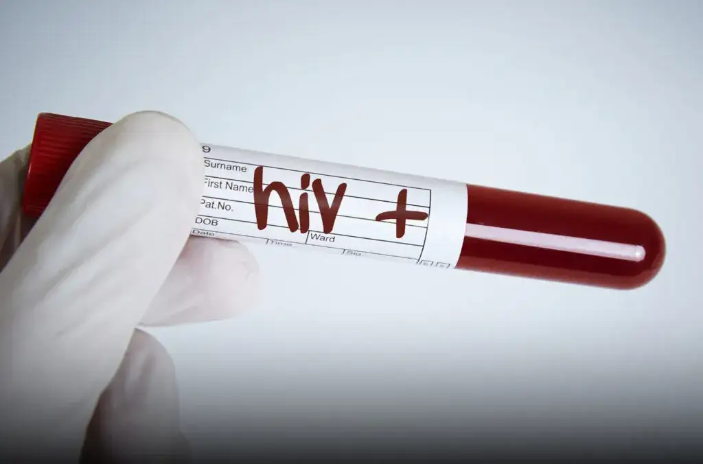 Gdzie zrobić badania na choroby weneryczne i uniknąć zagrożeń zdrowotnych