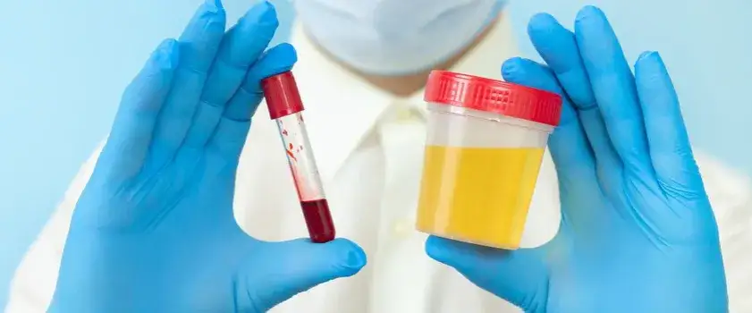 Leki na krwiomocz: skuteczne sposoby leczenia i przyczyny