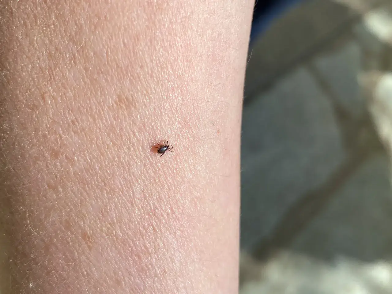 Wie oft muss man sich gegen Zecken impfen lassen, um sicher zu bleiben?