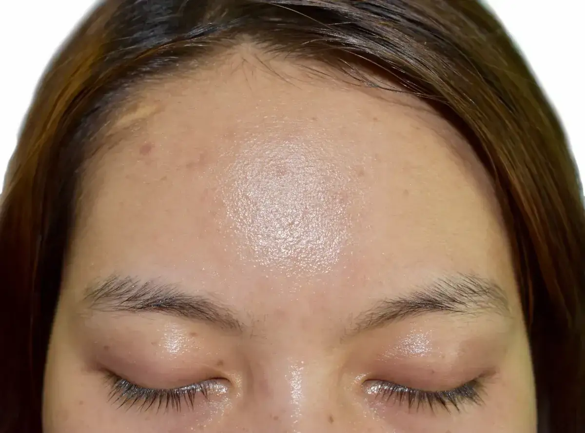 Cera tłusta? Skuteczna pielęgnacja: Matowa skóra bez niedoskonałości