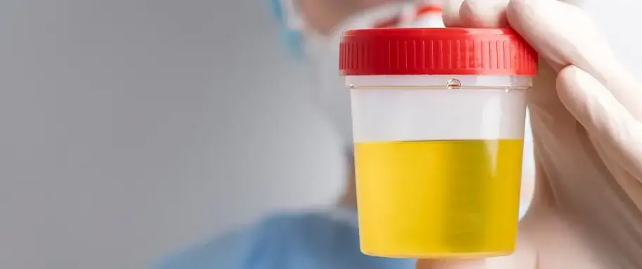 Podwyższone leukocyty: Co oznaczają? Przyczyny, normy i co robić