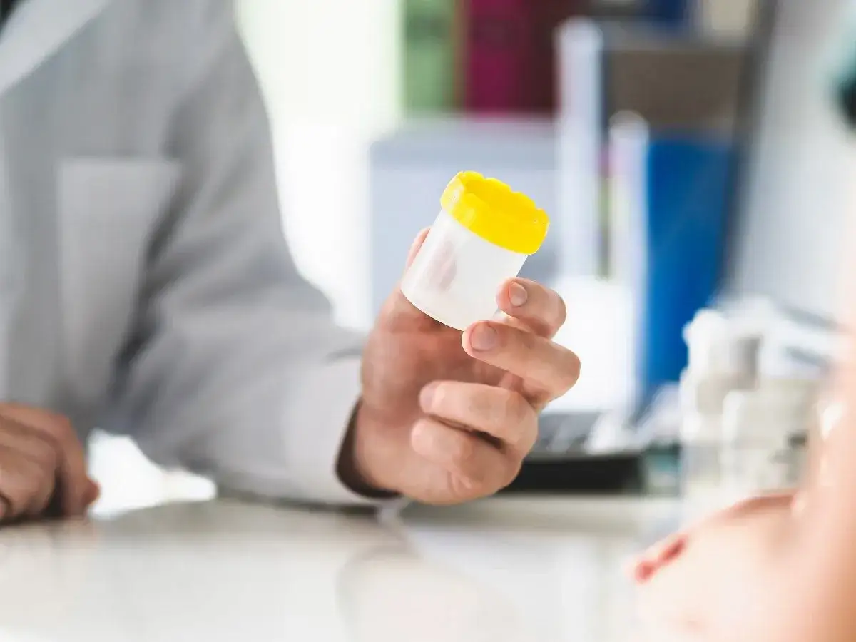 Ile kosztuje badanie kału? Ceny, NFZ i jak zaoszczędzić