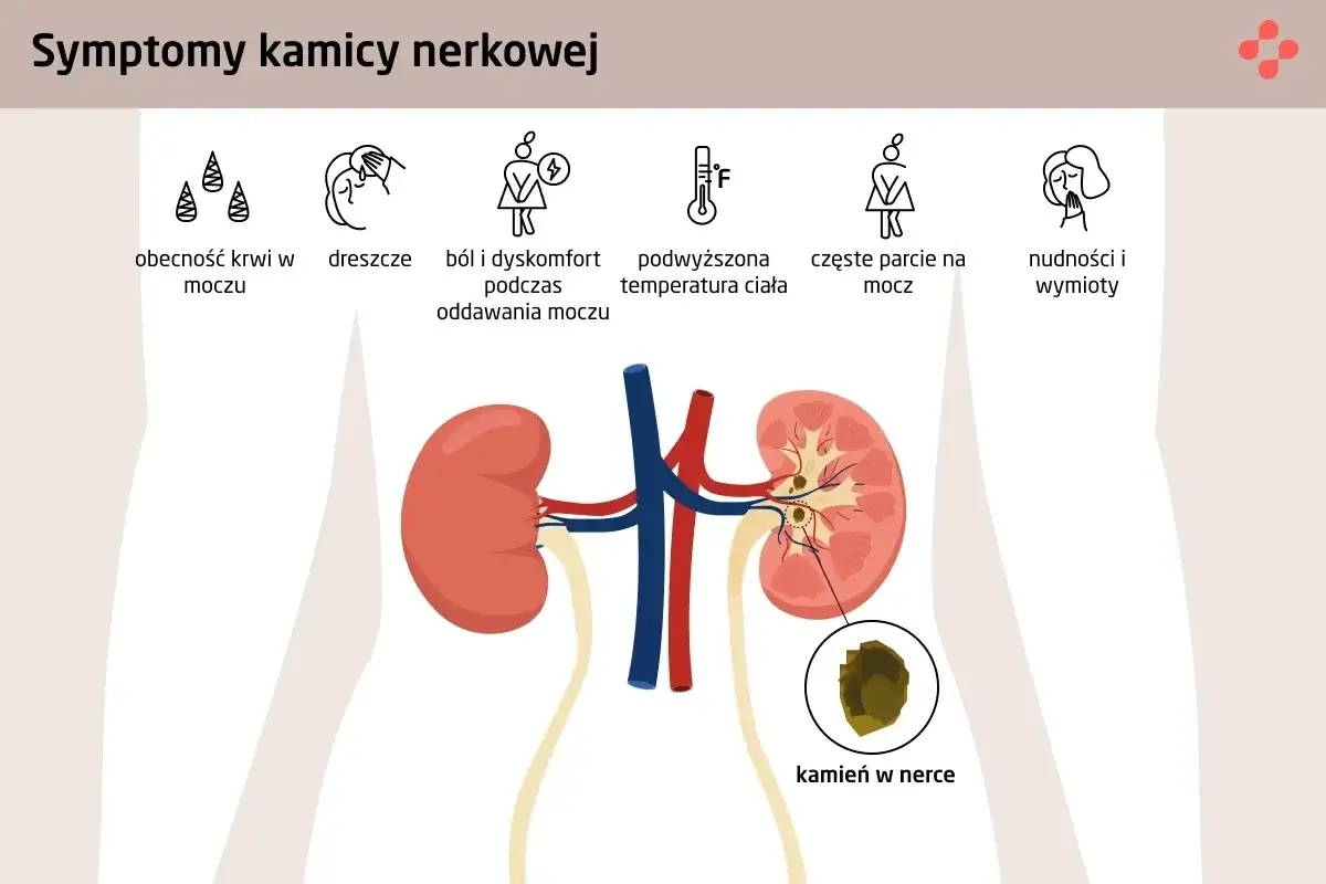 Diagnostyka kamicy nerkowej: Jakie badania i co oznaczają?