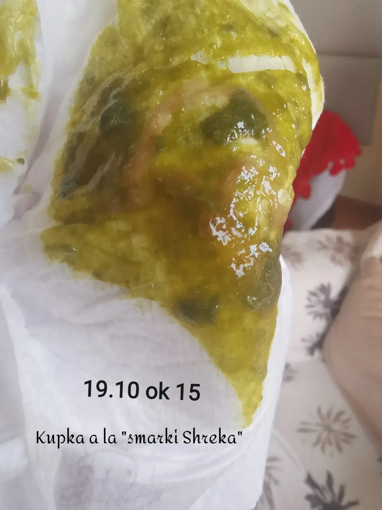 Kupy jak plastelina u niemowlaka – czy to normalne czy powód do niepokoju?