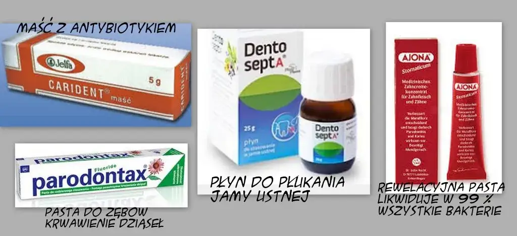 Jakie leki na zapalenie dziąseł? Skuteczne metody leczenia