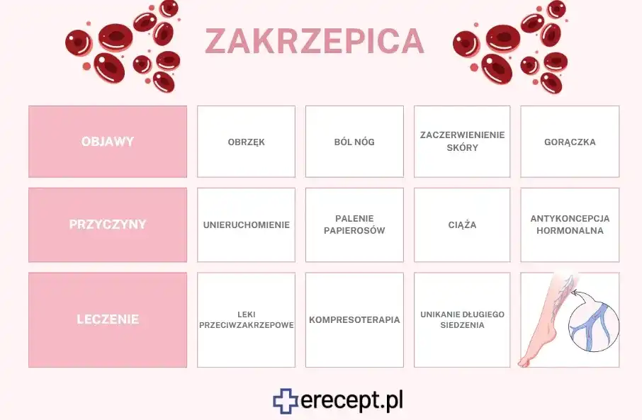 Zakrzepica: Jakie leki wybrać? Opcje, zasady i bezpieczeństwo