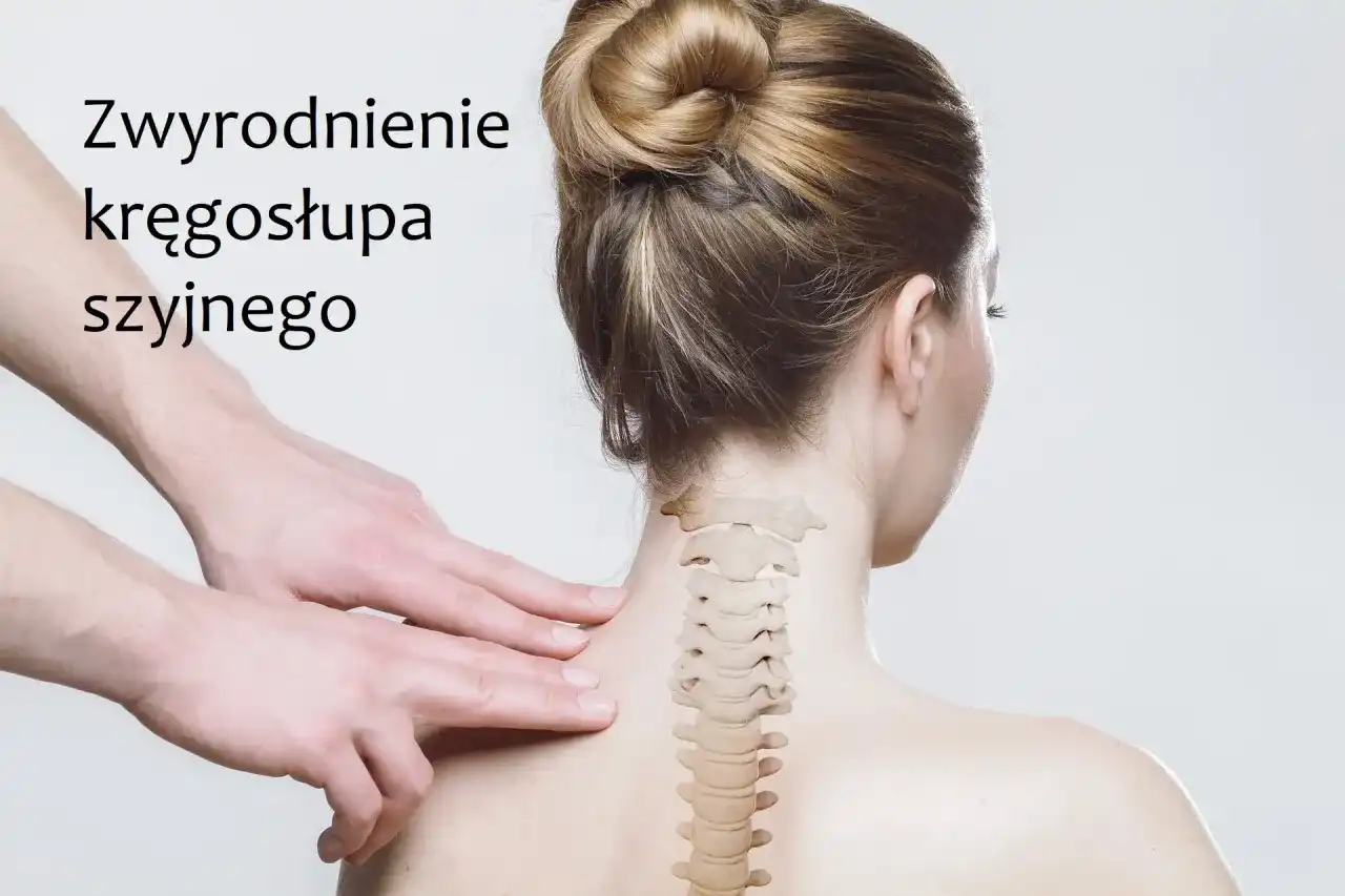 Leki na zwyrodnienie kręgosłupa szyjnego - co naprawdę działa?