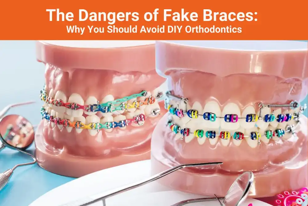 Fake braces: Jak zrobić i dlaczego to zły pomysł?