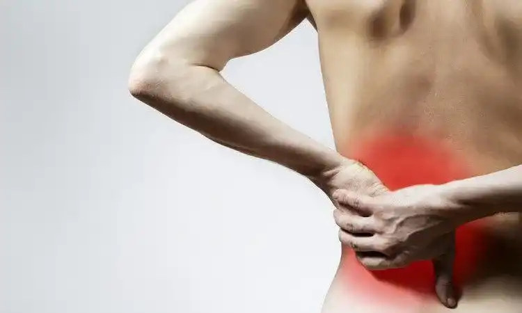 Kolka nerkowa objawy: jak rozpoznać ból i uniknąć niebezpieczeństw