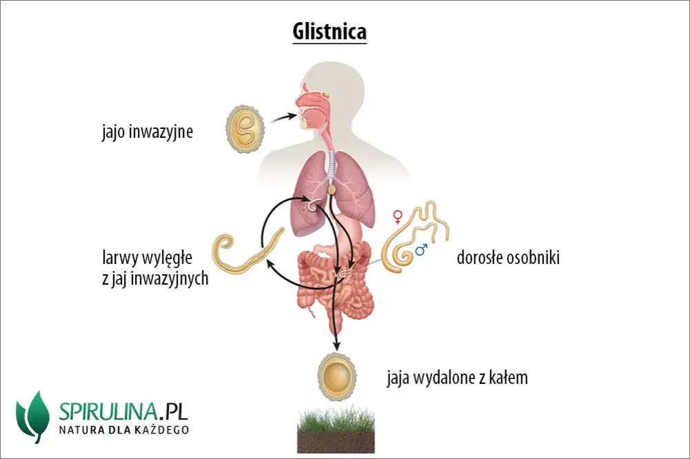 Glistnica u dziecka: Kluczowe objawy, których nie możesz przegapić