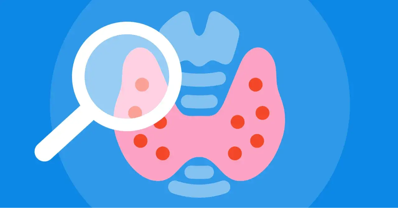 Ilustracja przedstawia tarczycę pod lupą, sugerującą diagnostykę subklinicznej niedoczynności tarczycy.