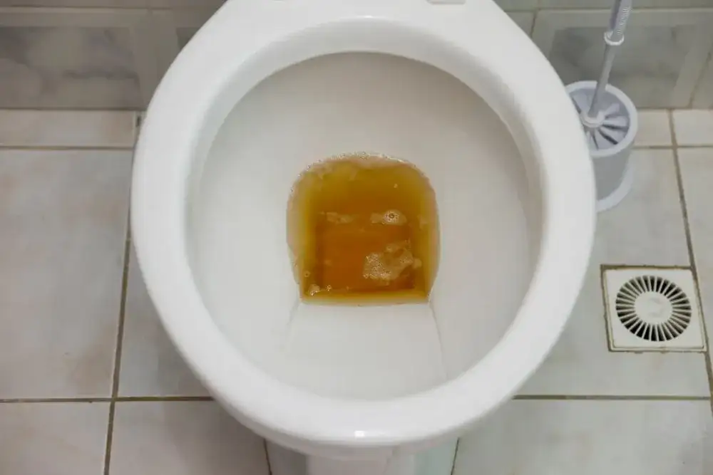 Przyczyny bardzo ciemnego moczu i co oznacza jego kolor?