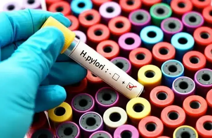 Jak wykryć Helicobacter pylori? Kluczowe badania dla Twojego zdrowia