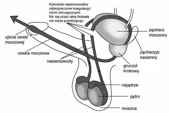Czy wazektomia to grzech? Moralne dylematy i nauka Kościoła