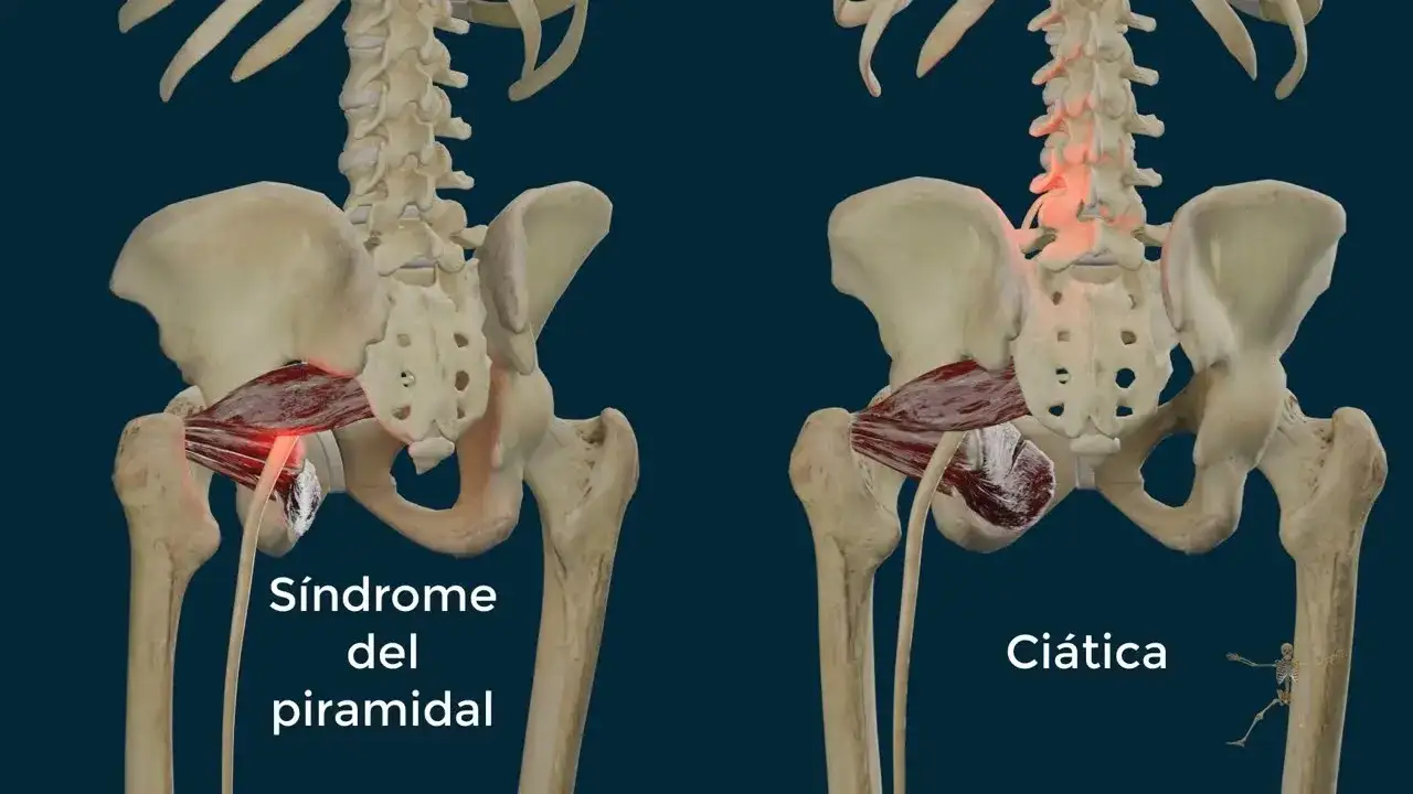 Músculos piramidales: diferencias clave entre piriforme y piramidal