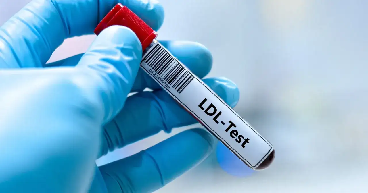 Ręka w niebieskiej rękawiczce trzyma probówkę z oznaczeniem "LDL-Test". Wynik badania wskazuje na podwyższony cholesterol LDL.