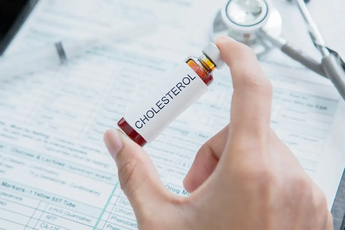 Dłoń trzyma fiolkę z napisem "CHOLESTEROL" na tle dokumentacji medycznej i stetoskopu. Czy tabletki na cholesterol trzeba brać do końca życia?