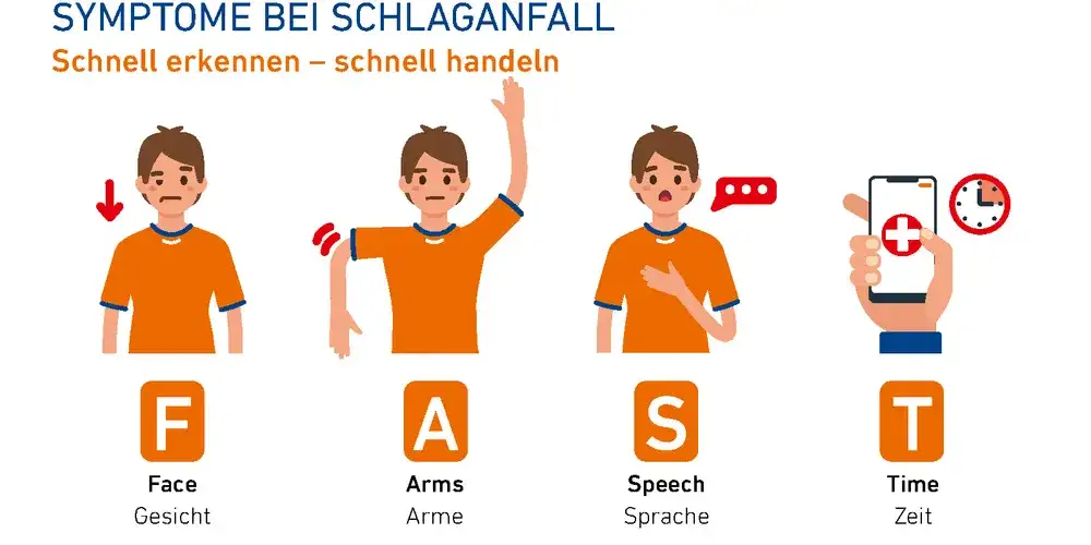 Apoplexie Symptome: Erkennen Sie die alarmierenden Anzeichen sofort